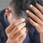 FUE oder FUT – Welche Haartransplantation ist besser für Sie?